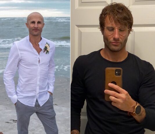 wigs hair loss lordhair