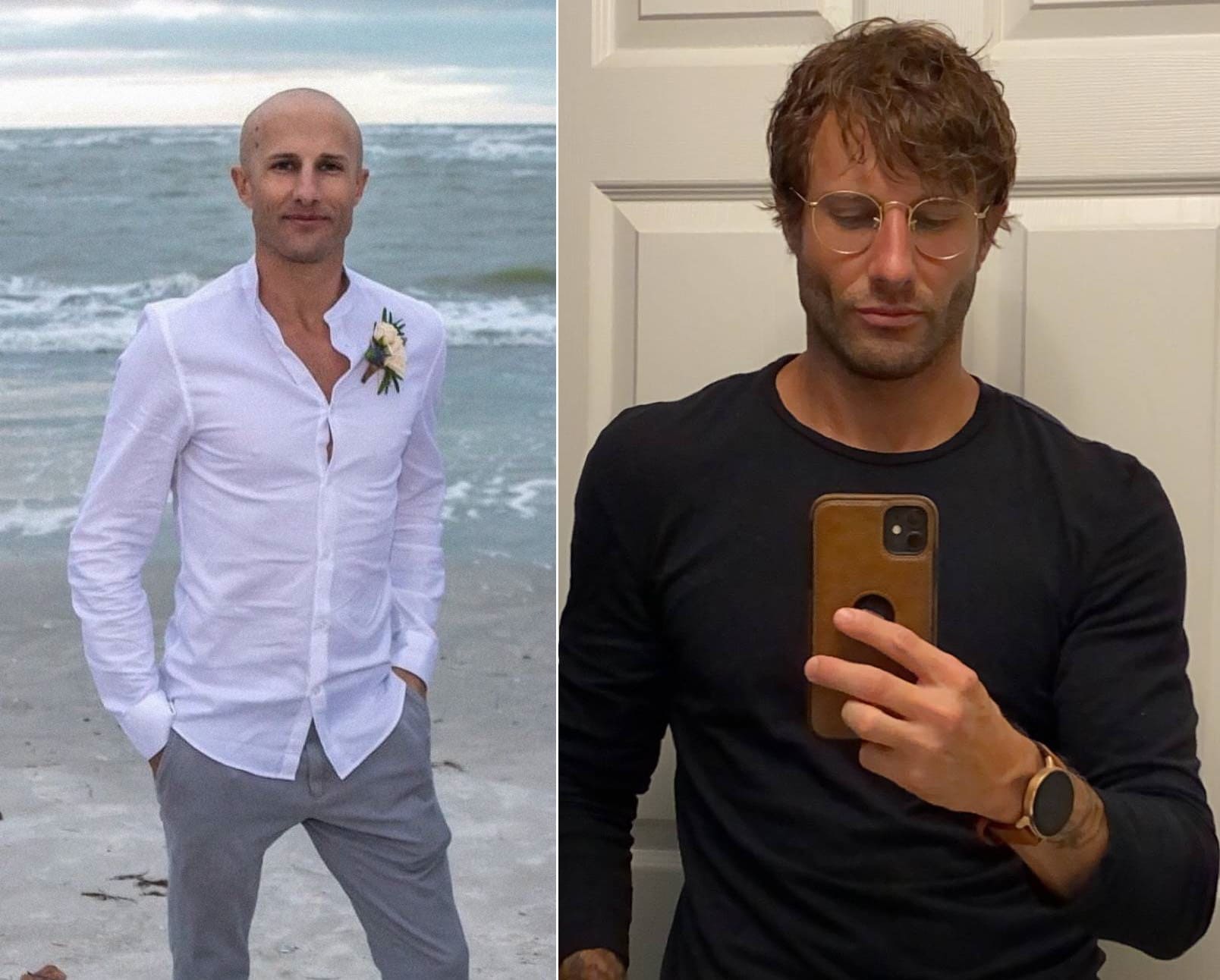 wigs hair loss lordhair