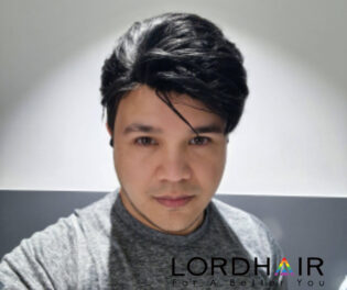 gay hair loss system 